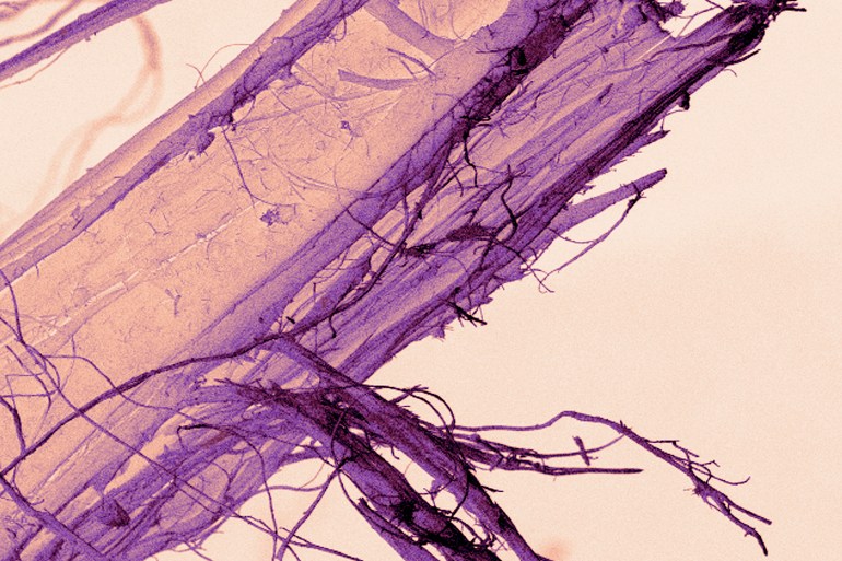 gettyimages-1131216147-1711028279-1 Scanning Electron micrograph of asbestos