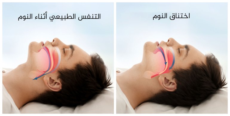 shutterstock_59705753110-1711377906 التنفس الطبيعي اثناء النوم واختناق النوم