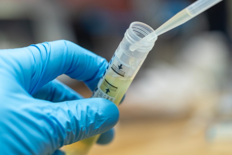 gettyimages-1170175839-1717855106 A urine sample collection tube for chlamydia PCR (polymerase chain reaction) testing which is commonly used in the laboratory to screen patients for chlamydia infection.