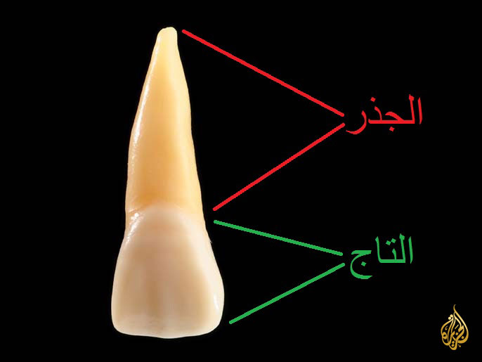 6abd2434-3939-449c-a149-9dc31ebd67d5 تصميم جذر السن السن أسنان تاج السن تشريح السن dental tooth root crown