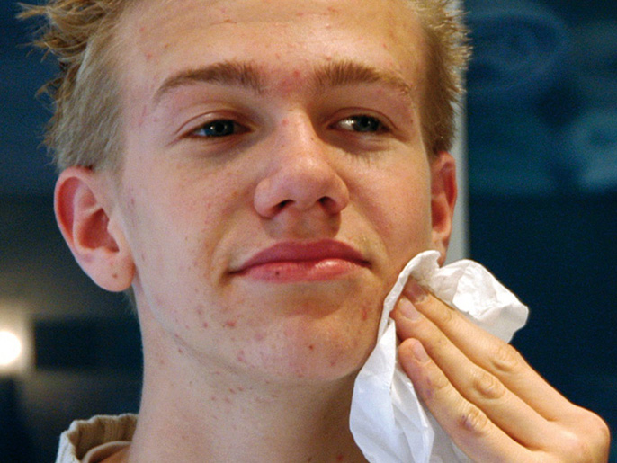 الأسماك والأطعمة الغنية بفيتامين "أ" و "د" تحسن شكل البشرة المصابة بحب الشباب