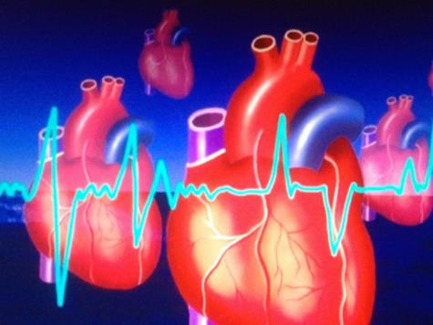 6a0469fa-8c22-4989-a208-0a54029e7305 تصوير حالة عمل القلب والخفقان