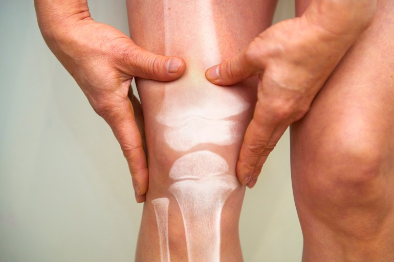 gettyimages-1180192938-1723901647 Physical Therapy trying to relieve pain, injury shown in x-ray