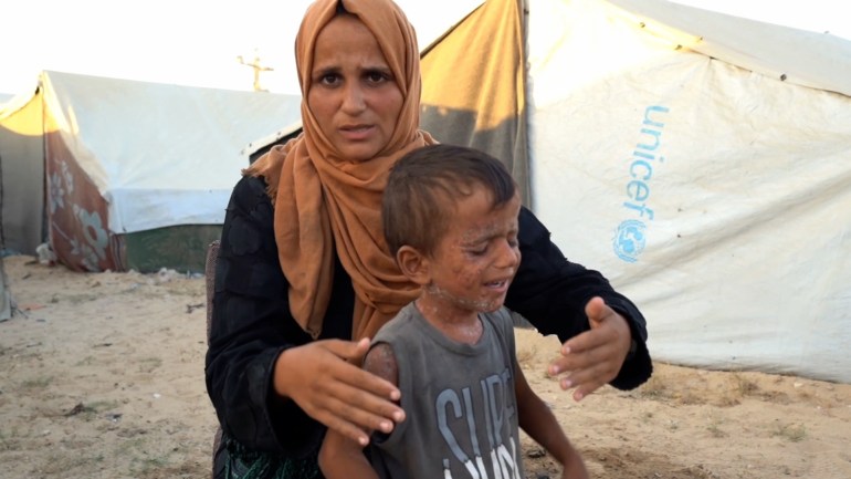 d8a8d98ad8b3-1725962394 نازحة فلسطينية داخل خيمتها وسط قطاع غزة تحاول إبعاد الذباب عن جسد طفلها فايز الذي يعاني من تقرحات جلدية وبثور كبيرة بسبب مرض جلدي تفاقم تأثيره في بيئة ملوثة سببتها الحرب الإسرائيلية على القطاع. ولا يكف فايز (4 سنوات) عن حك جسده المليء بالبثور والتقرحات التي تزداد اتساعا وانتشارا، بينما يعاني من مهاجمة الذباب دون أي حلول فعالة لتخفيف آلامه. ( İbrahim Nofal - وكالة الأناضول )