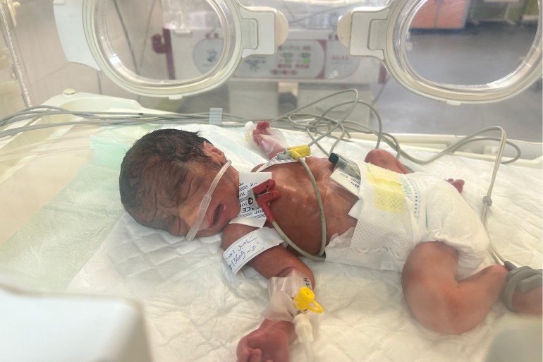 الطفل محمد أبو عواد يتلقى العلاج بعد ثلاثة أيام من ولادته وإصابته ، بتشوهات خلقية بالقلب، والقدمين، والدماغ اكتشفها الأطباء بعد الولادة. مجمع ناصر الطبي بمدينة خان يونس جنوب قطاع غزة، المراسل : محمد أبو شحمة