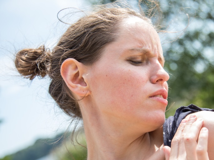 3e3c4140-d2b5-4118-b948-57f2e1b076d8 أعراض حساسية الشمس تتمثل في احمرار الجلد والحكة وظهور بثور أو عُقد. (النشر مجاني لعملاء وكالة الأنباء الألمانية “dpa”. لا يجوز استخدام الصورة إلا مع النص المذكور وبشرط الإشارة إلى مصدرها.) عدسة: dpa صور: Christin Klose/dpa-tmn/dpa