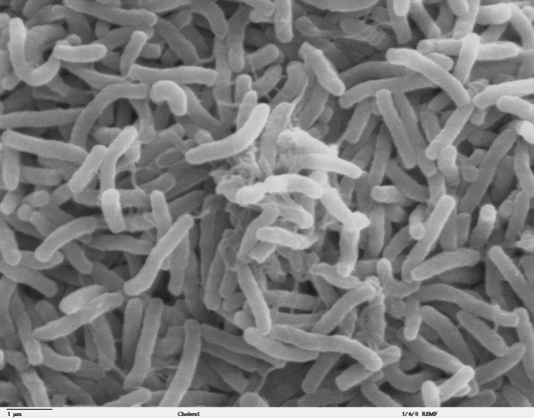 cholera_bacteria_sem-1731395342 بكتيريا الكوليرا في المجهر الالكتروني (ويكيميديا)