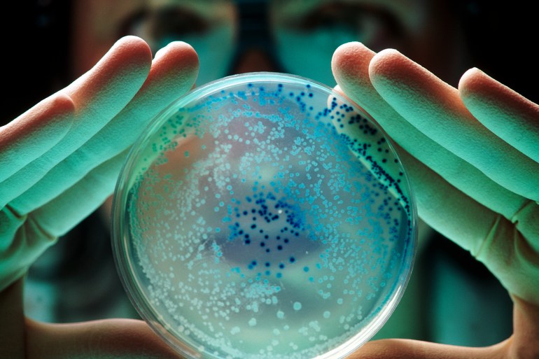 gettyimages-521677434 escherichia bacteria