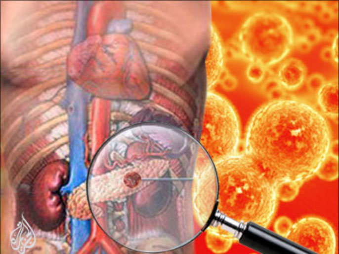 6e6058b9-3363-4778-b887-1c324c4eaff6 سرطان البنكرياس