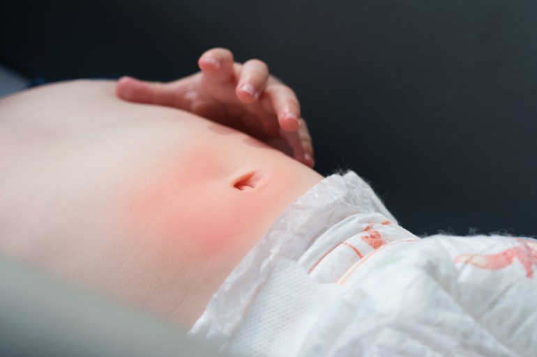 Baby or toddler belly pain concept.