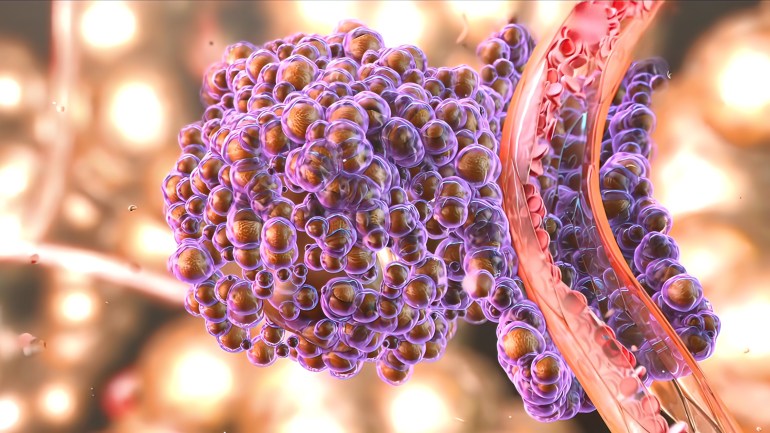 ss2160478605 SS2160478605 سرطان cancer