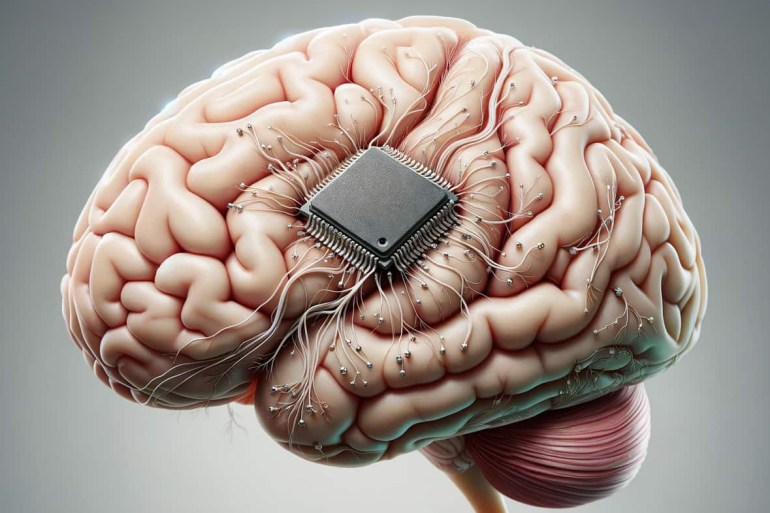 neurolink-3-1707656496 Elon Musk’s Neuralink puts its first chip in a human brain, but faces a long road ahead — and a potential nightmare scenario (Photo credit: OpenAI's DALL·E)