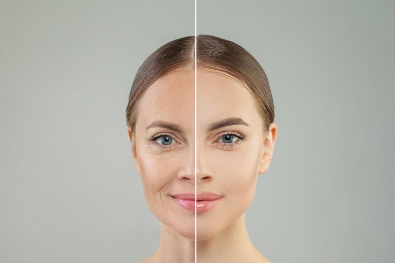 wrinkles-1714325385 Old and young woman on white background; الوجه الأوزمبيك وجه أوزمبي ozempic face Shutterstock ID 2342804169; purchase_order: aljazeera ; job: ; client: ; other: