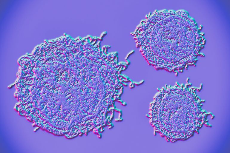 56gy-1745425099 Cancer cells, illustration
