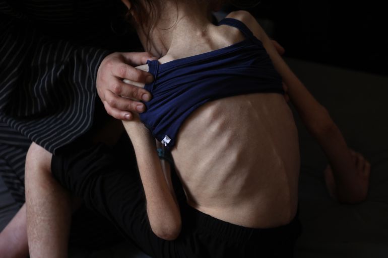 afp_6818744cf2f9-1746433101 Shuruq Ayyad shows off the protruding ribs of her 12-year-old daughter Rahaf at a school-turned-shelter in al-Rimal in central Gaza City on May 4, 2025.