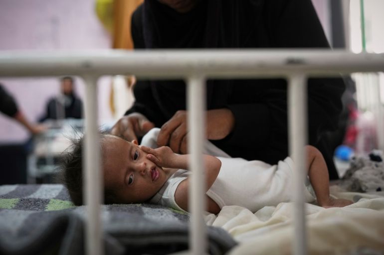 ap_6818c31730764-1746453271 Rahma al-Qadi takes care for her 7-month-old daughter Sama, who was born with Down syndrome and suffers from malnutrition, at the malnutrition clinic in Nasser hospital, Khan Younis, Gaza, Thursday, May 1, 2025. (AP Photo/Abdel Kareem Hana)