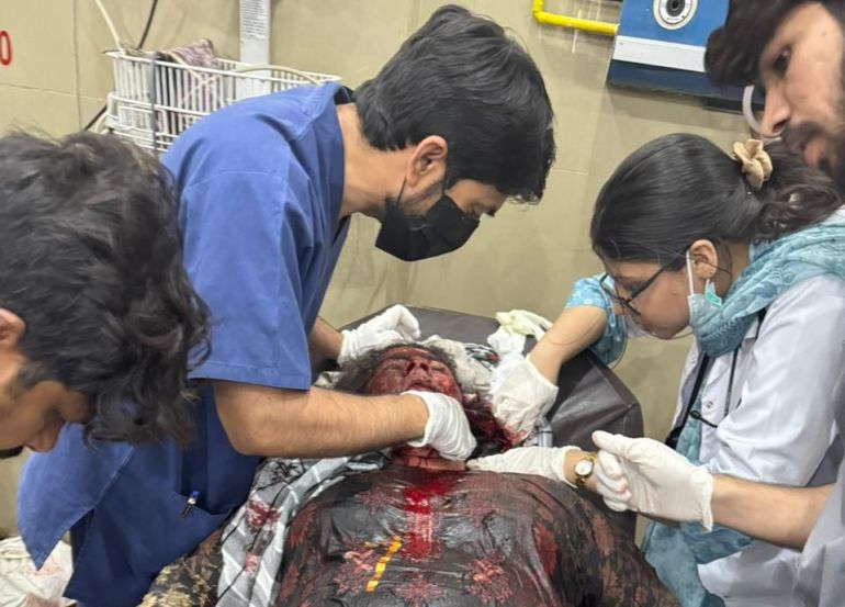 epa_681b04908dff-1746601104-e1746607891455 epa12078850 A handout photo made available by the Pakistani military Inter Services Public Relations, shows a person being treated after suffering injuries during a suspected Indian missile attack, at a hospital in Bahawalpur, Pakistan, 07 May 2025. India said it conducted military strikes on nine sites in Pakistan in retaliation for a deadly militant attack on tourists in Kashmir. EPA-EFE/ISPR / HANDOUT HANDOUT EDITORIAL USE ONLY/NO SALES