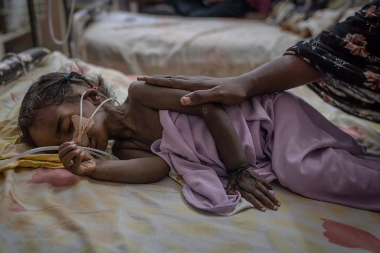 OMDURMAN, SUDAN. April 26, 2025. Two-year-old Riham Ata, who was admitted from a recently liberated area of Khartoum, lies on a gurney in one of Al-Buluk Hospital's severe malnutrition wards in Omdurman. Al-Buluk was Khartoum's only functioning pediatric hospital during the two-year civil war that began in April 2023.(Photo by Giles Clarke/Avaaz via Getty Images)