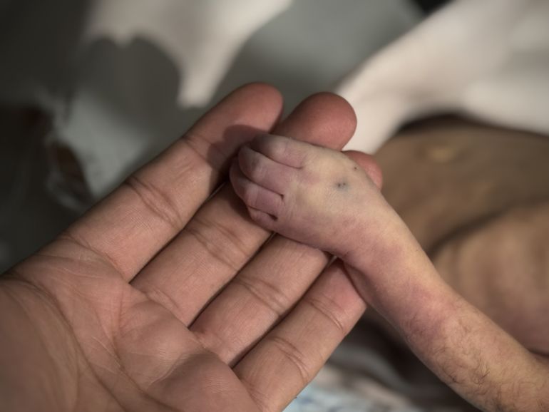47-2-1766311674 أعلنت وزارة الصحة بقطاع غزة، الخميس، وفاة رضيع فلسطيني جراء انخفاض شديد في درجات الحرارة، بالتزامن مع موجة برد تشهدها البلاد. وذكرت الوزارة في بيان أن الرضيع سعيد أسعد عابدين البالغ من العمر شهرا توفي نتيجة الانخفاض الشديد في درجات الحرارة. ( Abdallah F.s. Alattar - وكالة الأناضول )