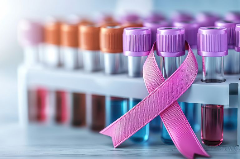 Breast cancer awareness professional medical concept. Bottles of test tubes with a pink ribbon symbolizing breast cancer awareness. - المصدر: أدوبي ستوك