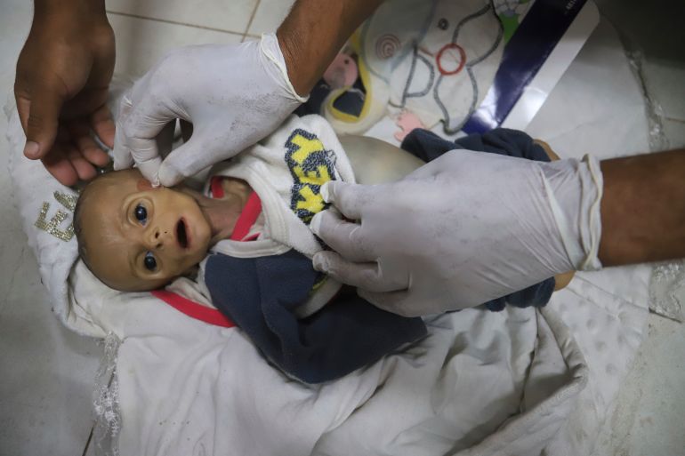 ap_68a85983723b5-1755863427 EDS NOTE: GRAPHIC CONTENT - A morgue worker prepares the body of 5-month-old baby, Zainab Abu Halib, who died from malnutrition-related causes, according to Dr. Ahmed al-Farah, head of the pediatric department at Nasser Hospital, before her funeral in Khan Younis, Gaza Strip, July 26, 2025. (AP Photo/Mariam Dagga)
