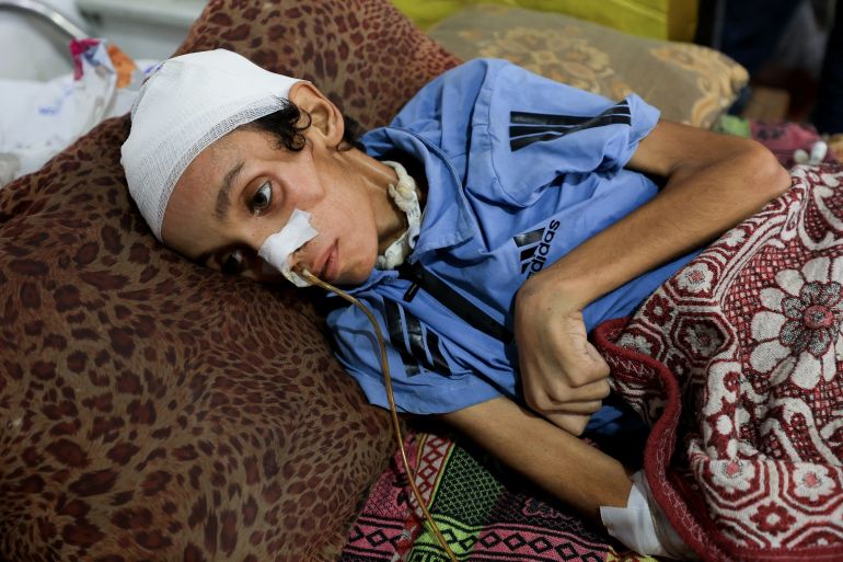 Palestinian boy Mosab al-Debs, 14, who is malnourished according to medics, lies on a bed at al-Shifa Hospital in Gaza City. [Dawoud Abu Alkas/Reuters]
