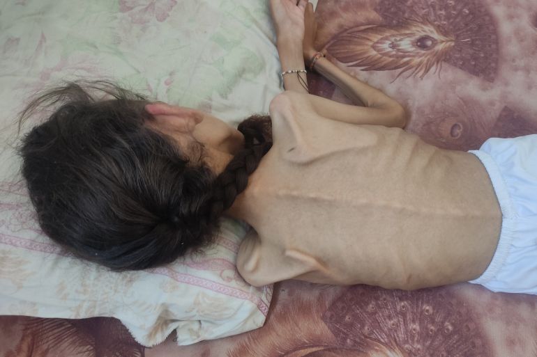 قصة... في عظام الطفلة مريم.. يبرز صوت المجاعة في غزة المحاصرة