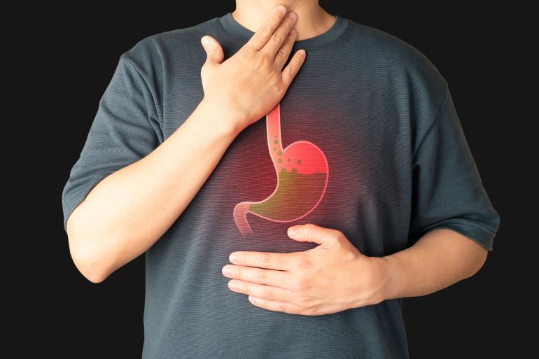 shutterstock_2330002975-1769187923 Gastroesophageal reflux disease (GERD) or acid reflux symptoms. Man suffering from heartburn, stomachache, nausea and bloating. Gastrointestinal system disease and digestive problems.