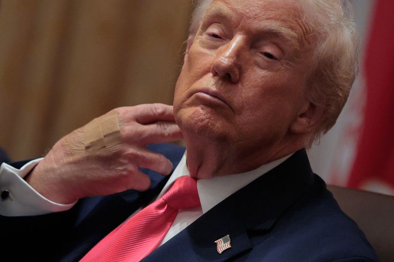 WASHINGTON, DC - DECEMBER 02: U.S. President Donald Trump wears adhesive bandages on the back of his hand during a meeting of his cabinet in the Cabinet Room of the White House on December 02, 2025 in Washington, DC. A bipartisan Congressional investigation has begun about Defense Secretary Pete Hegseth's role in ordering U.S. military strikes on small boats that have killed scores of people in the waters off Venezuela, which Hegseth said are intended "to stop lethal drugs, destroy narco-boats and kill the narco-terrorists who are poisoning the American people.” Chip Somodevilla/Getty Images/AFP (Photo by CHIP SOMODEVILLA / GETTY IMAGES NORTH AMERICA / Getty Images via AFP)