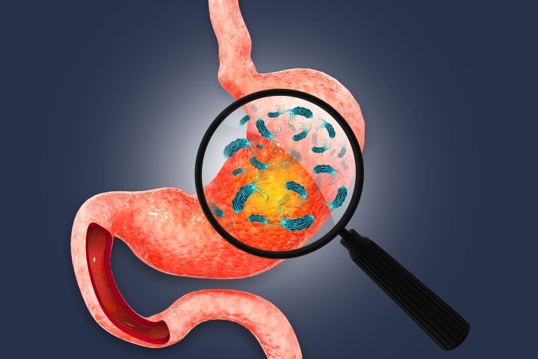 shutterstock_2557652575-1773934224 Helicobacter Pylori in the stomach, Stomach diseases. 3d illustration; Shutterstock ID 2557652575; purchase_order: aj; job: ; client: ; other: