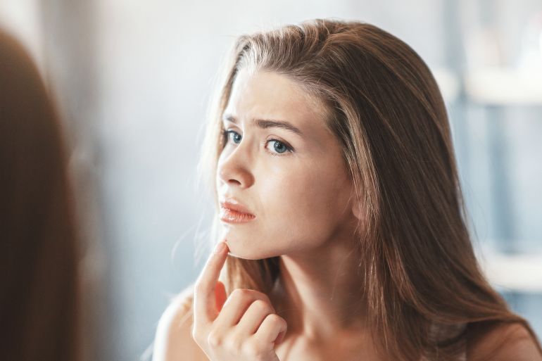 Upset millennial girl touching pimple on her chin in front of mirror at home