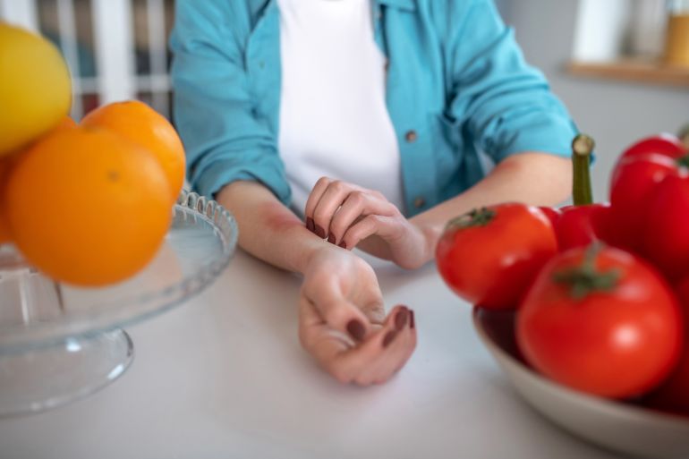 Being alergic to tomatoes and oranges. Woman eating products causing an alergy