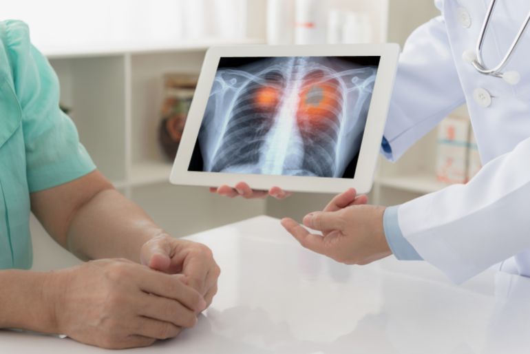 lung cancer concept. doctor explaining results of lung check up from x-ray scan chest on digital tablet screen to patient.; Shutterstock ID 1135032728; purchase_order: aljazeera ; job: ; client: ; other: