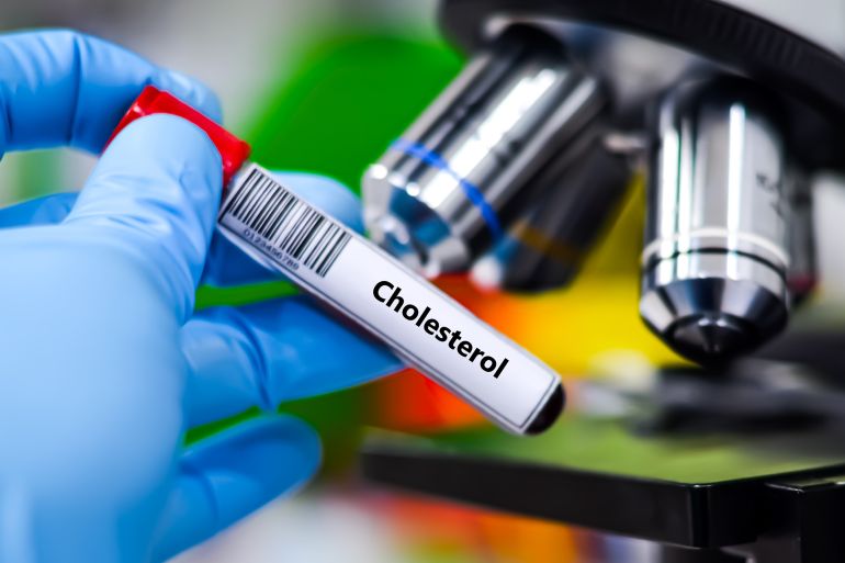 Blood sample tube for cholesterol test analysis.; Shutterstock ID 2652563569; purchase_order: aj; job: ; client: ; other:
