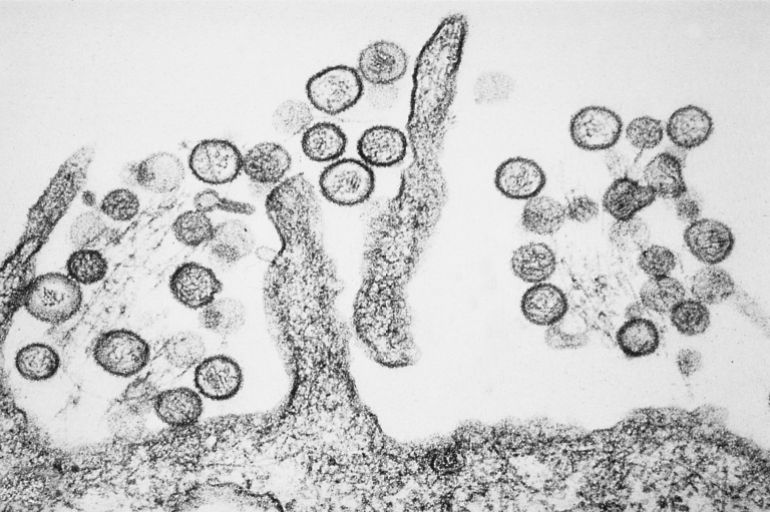Transmission electron micrograph of the Sin Nombre Hantavirus. Hantaviruses that cause Hantavirus pulmonary syndrome (HPS) are carried in rodent droppings, especially the deer mouse. Incubation lasts for 1–5wks. Sickness begins with fever and muscle aches, followed by shortness of breath and coughing.فيروس الهانتا تحت الميكرسكوب (مركز السيطرة على الأمراض)