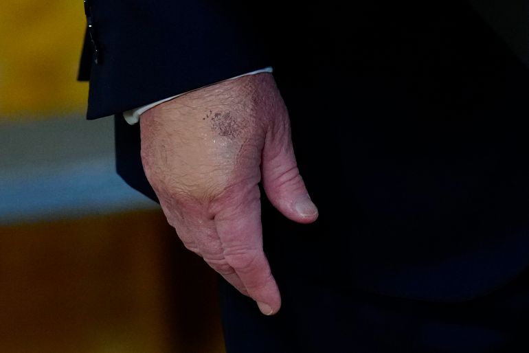 President Donald Trump's right hand is seen during a Mother's Day event for members of the military, Wednesday, May 6, 2026, in the East Room of the White House, in Washington. (AP Photo/Jacquelyn Martin)