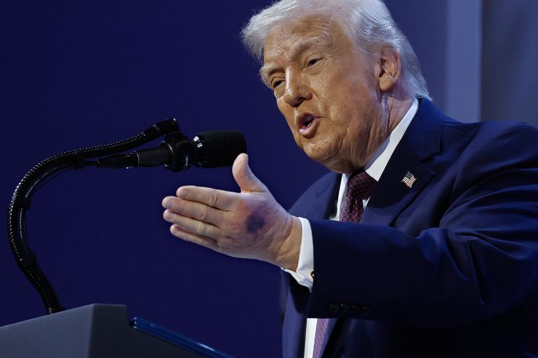 DAVOS, SWITZERLAND - JANUARY 22: A bruise can be seen on the back of U.S. President Donald Trump's left hand during a signing ceremony for the “Board of Peace” at the World Economic Forum (WEF) on January 22, 2026 in Davos, Switzerland. The US-backed “Board of Peace” is intended to administer the fragile ceasefire in the Gaza Strip after the war between Israel and Hamas. The final makeup of the board has not been confirmed. (Photo by Chip Somodevilla/Getty Images)
