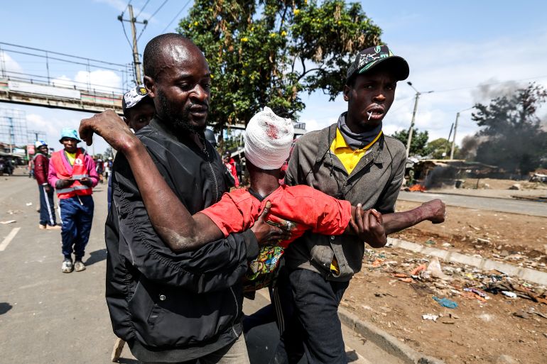 epa12222560 An injured protester is assisted after being shot with a rubber bullet by anti-riot police during anti-government protests on Saba Saba day (or Seven-Seven in Swahili language) in Nairobi, Kenya, 07 July 2025. Nairobi’s Central Business District remained on a lockdown as most business owners hired counter-protesters armed with clubs to protect their business from looters as police used tear gas and rubber bullets to disperse hundreds of protestors in the outskirts of Nairobi during the protest. The Saba Saba Day commemorates protests and government crackdown on a multi-party democracy movement in Kenya in the 1990s. EPA/DANIEL IRUNGU WARNING GRAPHIC CONTENT