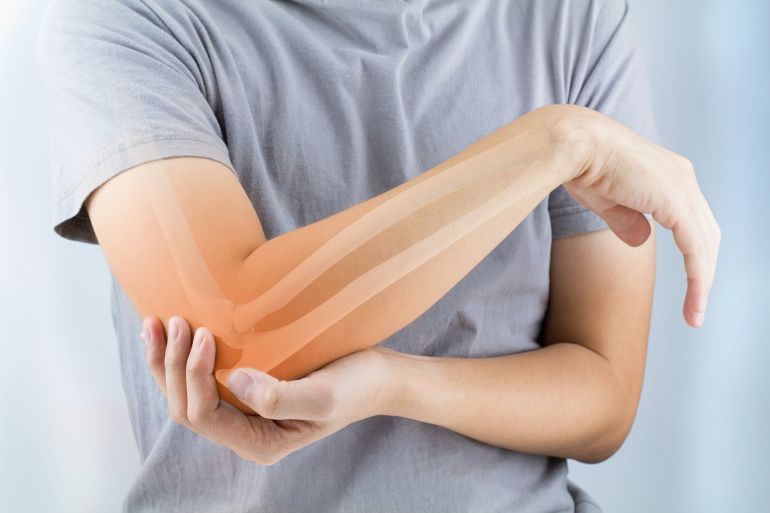 shutterstock_477270304-1702211710 elbow bones injury; Shutterstock ID 477270304; purchase_order: aljazeera ; job: ; client: ; other: