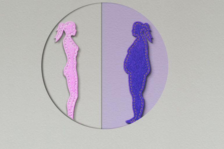 30-1784456608 Photo Concept Portraying Body Dysmorphic Disorder, Bulimia, Anorexia Nervosa,