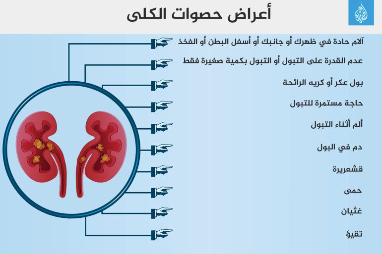 555555555555555 انفوجراف أعراض حصوات الكلى Kidney stones حصوات الكلى حصى الكلى كلى كلية الكليه كليتين