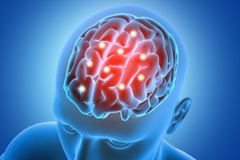 adobestock_165235368-1784832824 3D medical background with male figure with brain parts highlighted المصدر: أدوبي ستوك