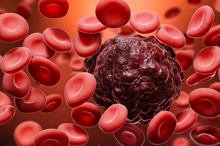 e5td-1756054291 Cancer cell amidst red blood cells 3D rendering illustration. Oncology, cancerology, metastasis, medicine, microbiology, science, illness, health concepts.