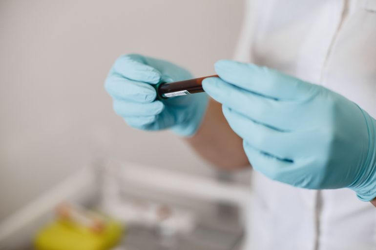 Close-up of a lab technician holding a blood sample vial in a medical laboratory setting.
