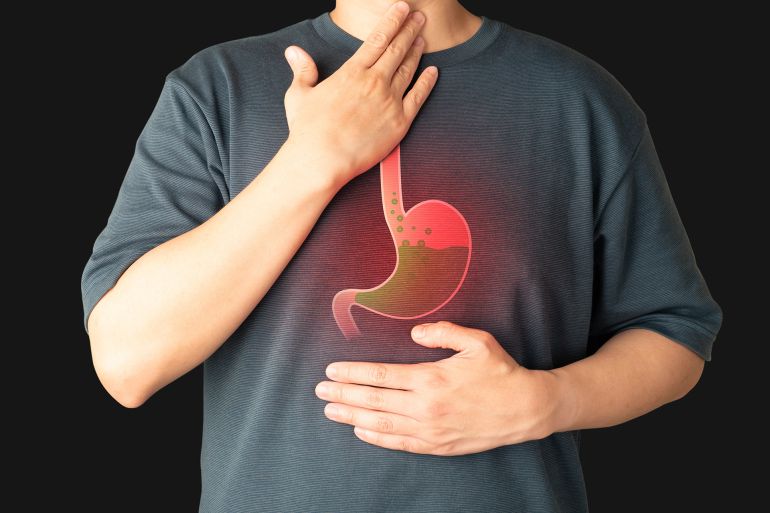 678uy4-1777050326 Gastroesophageal reflux disease (GERD) or acid reflux symptoms. Man suffering from heartburn, stomachache, nausea and bloating. Gastrointestinal system disease and digestive problems.