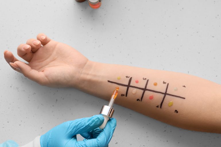 Doctor with dropper making allergy skin test on patient's hand in clinic, closeup by Pixel-Shot @ادوبي ستوك