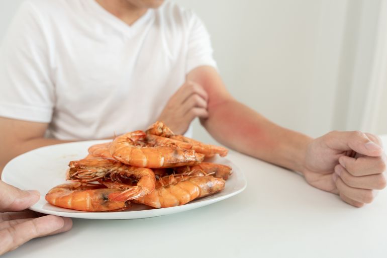 food allergies, men have reactions itching and redness after eating shrimp, seafood allergy, itching, rash, abdominal pain, diarrhea, chest tightness, unconsciousness, death, severe avoid allergies