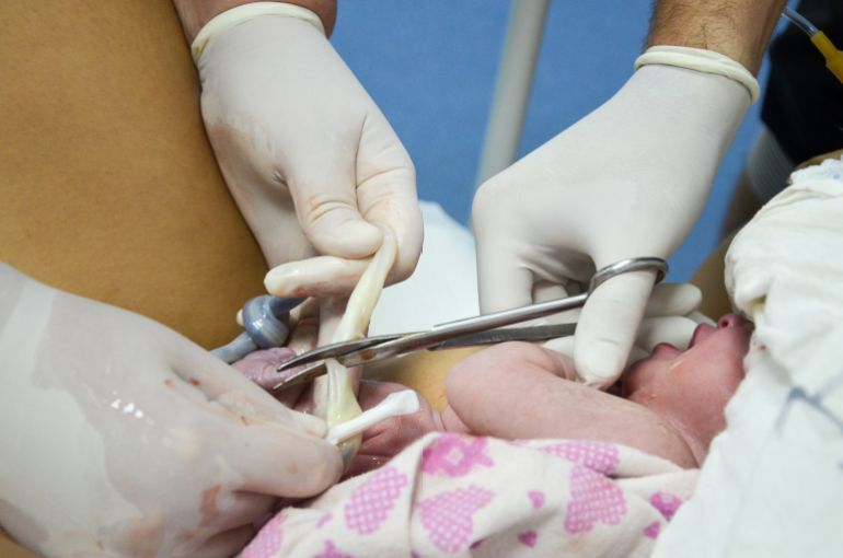Cutting the umbilical cord between a newborn baby and placentaالمصدر: أدوبي ستوك