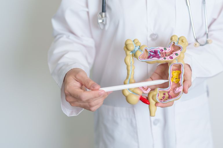 shutterstock_2327784177-1752049048 Doctor holding human Colon anatomy model. Colonic disease, Large Intestine, Colorectal cancer, Ulcerative colitis, Diverticulitis, Irritable bowel syndrome, Digestive system and Health concept