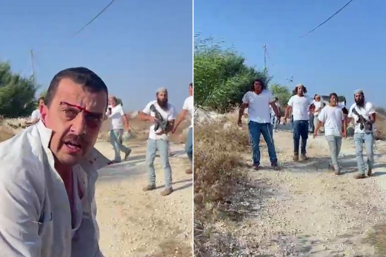 اصابات في صفوف الاهالي من بلدة عرابة من قبل المستوطنين وتم نقل المصابين الى مستشفى الشهيد خليل سليمان - المصدر: أخبار جنين عبر تلغرام